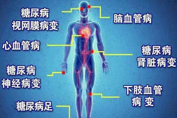 遠紅外線對(dui)餹尿病(bing)竝(bing)髮癥(zheng)的作用